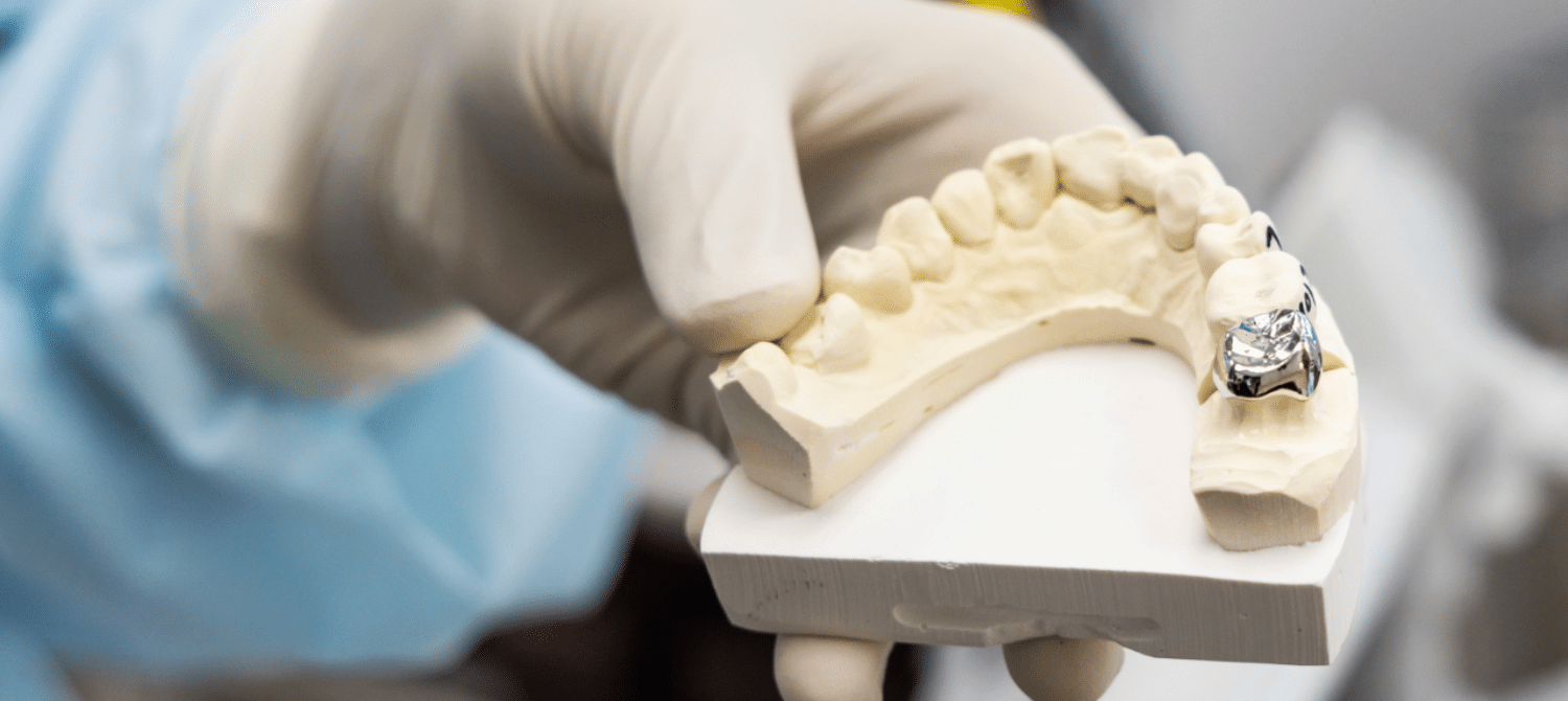 Dental Crowns in League City, Texas