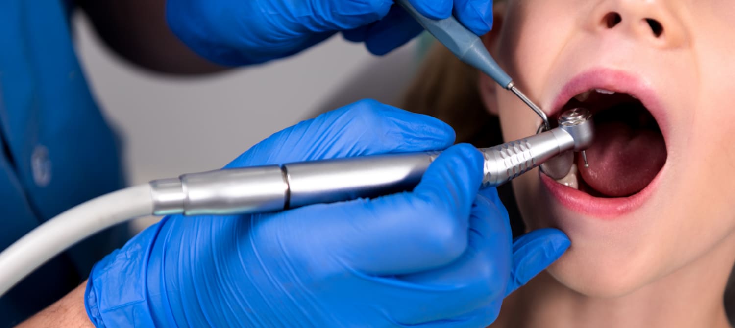dental implants In League City, Texas