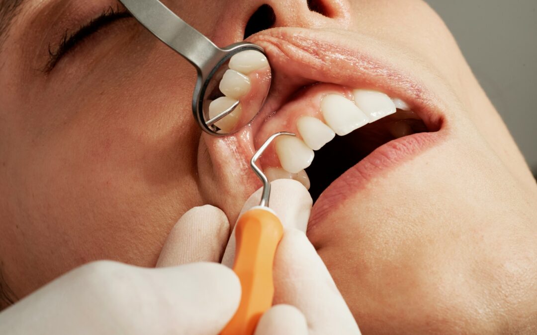 Why Local Expertise Matters: The Advantages of Choosing a Texas City-Based Dentist