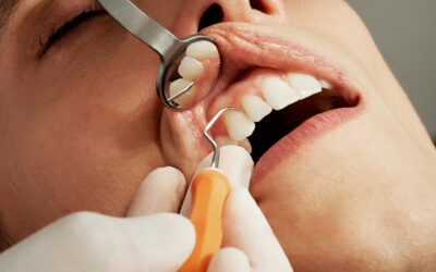 Why Local Expertise Matters: The Advantages of Choosing a Texas City-Based Dentist