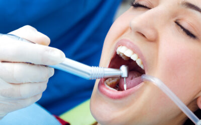 What to Expect During a Dental Crown Procedure in League City