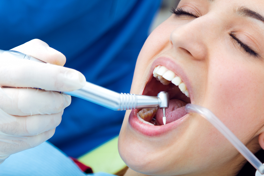 What to Expect During a Dental Crown Procedure in League City