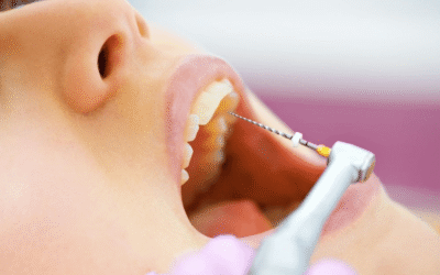 Is a Root Canal Painful? Here’s the Truth