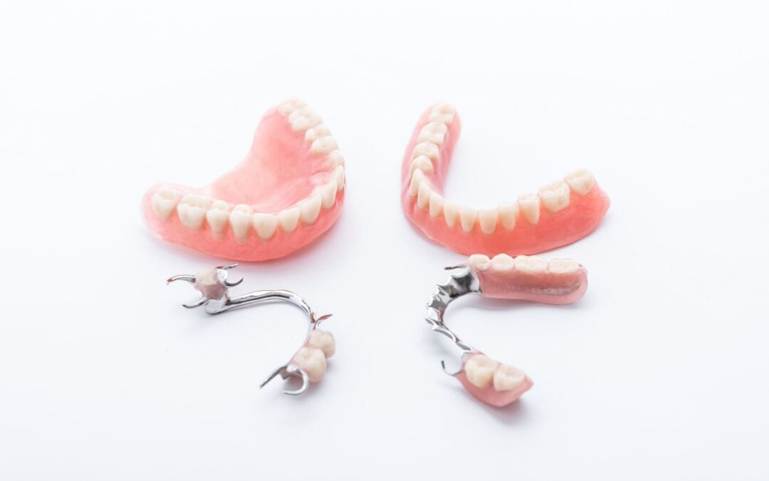 League City Dentures: Selecting the Best Tooth Replacement Option